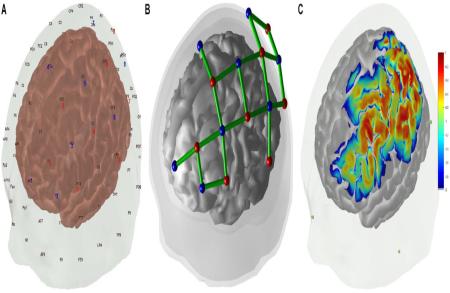 Rehabilitation strategies combining neuromuscular electrical stimulation and mirror neurons