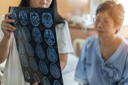 Is there a connection between stroke, TDP-43 and ALS?